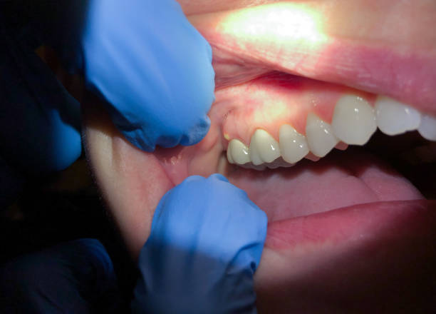 Best Emergency TMJ Treatment in Boaz, AL