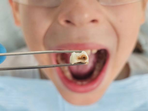 Best Cosmetic Emergency Dentistry in Boaz, AL